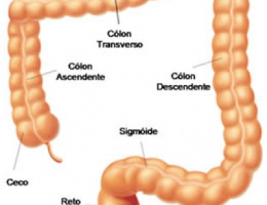 Saiba mais sobre câncer Colorretal / Intestino Grosso